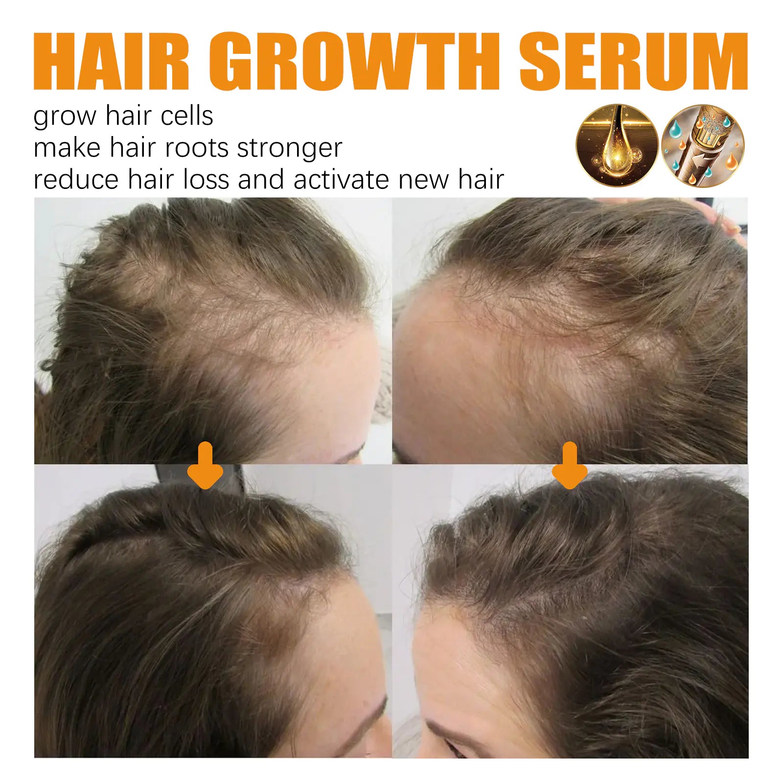 30ml Hair Growth Essence for Strong, Thick Hair Care