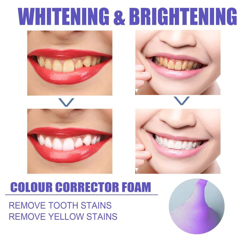 Black & Yellow Tooth Stain Foam Whitening Toothpaste