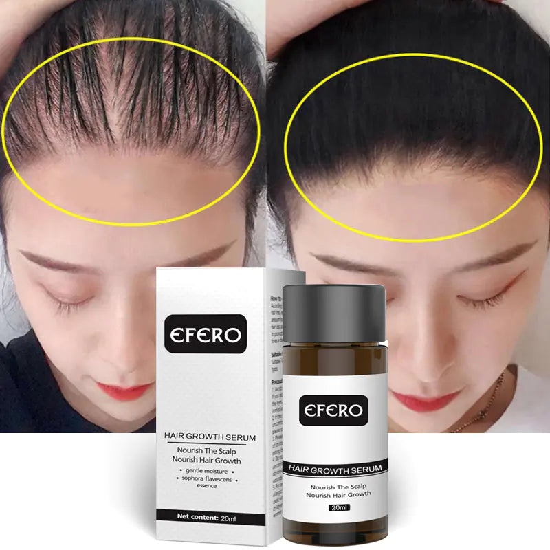 Efero Hair Growth Serum for Stronger Roots and Length