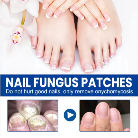 Nail Repair Adhesive Patches
