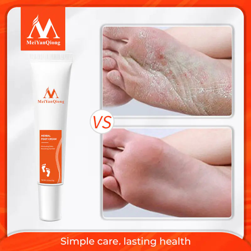 Herbal Beriberi Ointment for Foot Care (New Packaging)