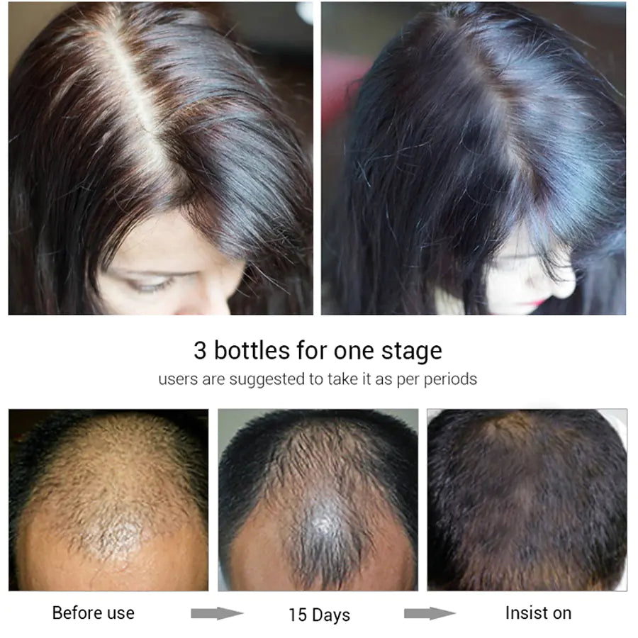 Efero Hair Growth Serum for Stronger Roots and Length