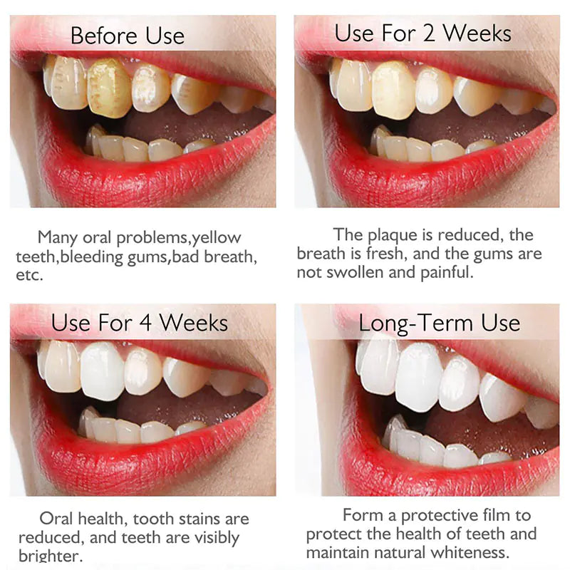 Black & Yellow Tooth Stain Foam Whitening Toothpaste