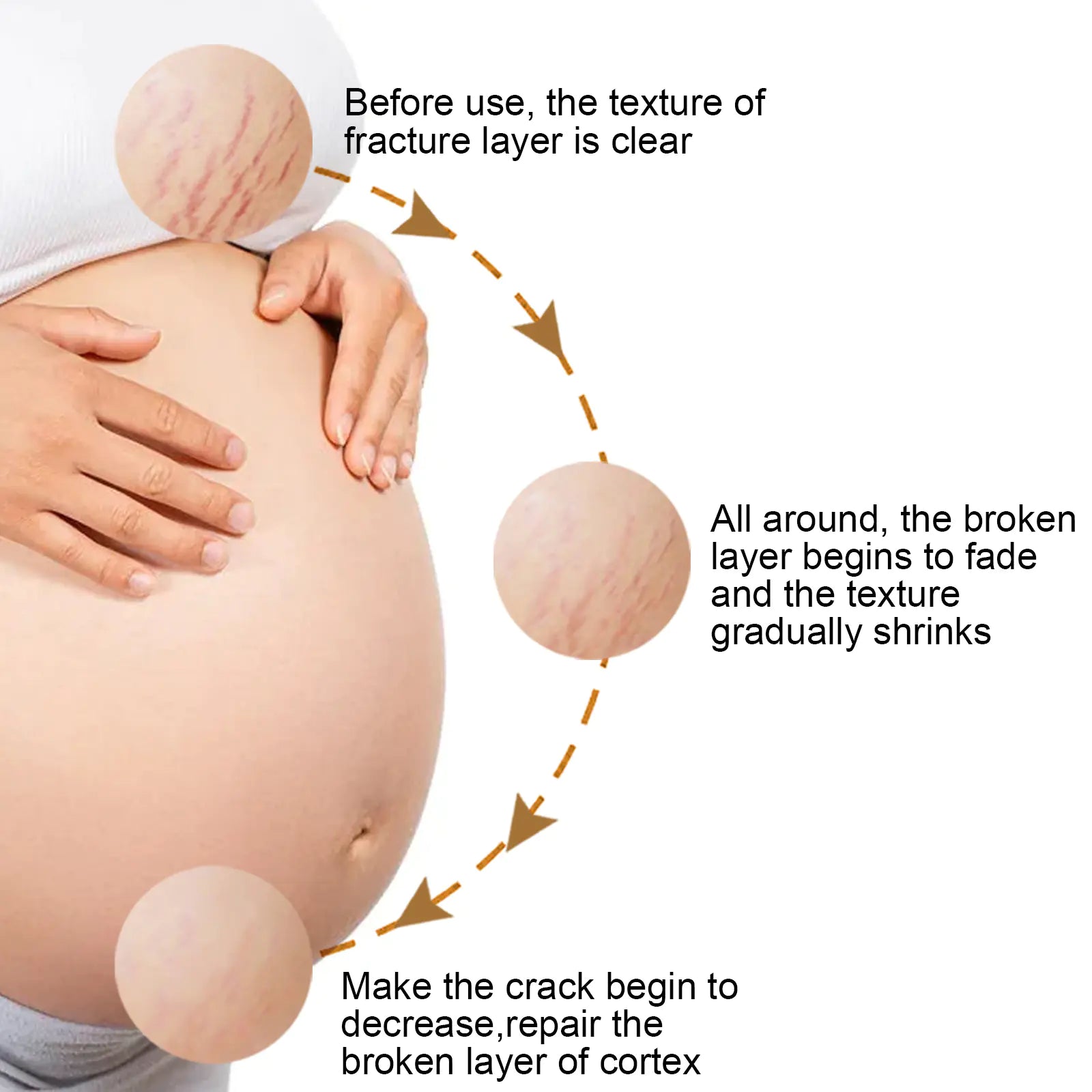 EELHOE Skin Care Cream for Pregnancy and Scars