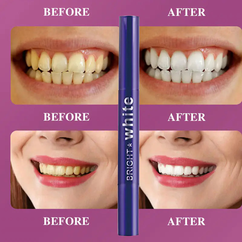 Mini Portable Tooth Cleaning Pen