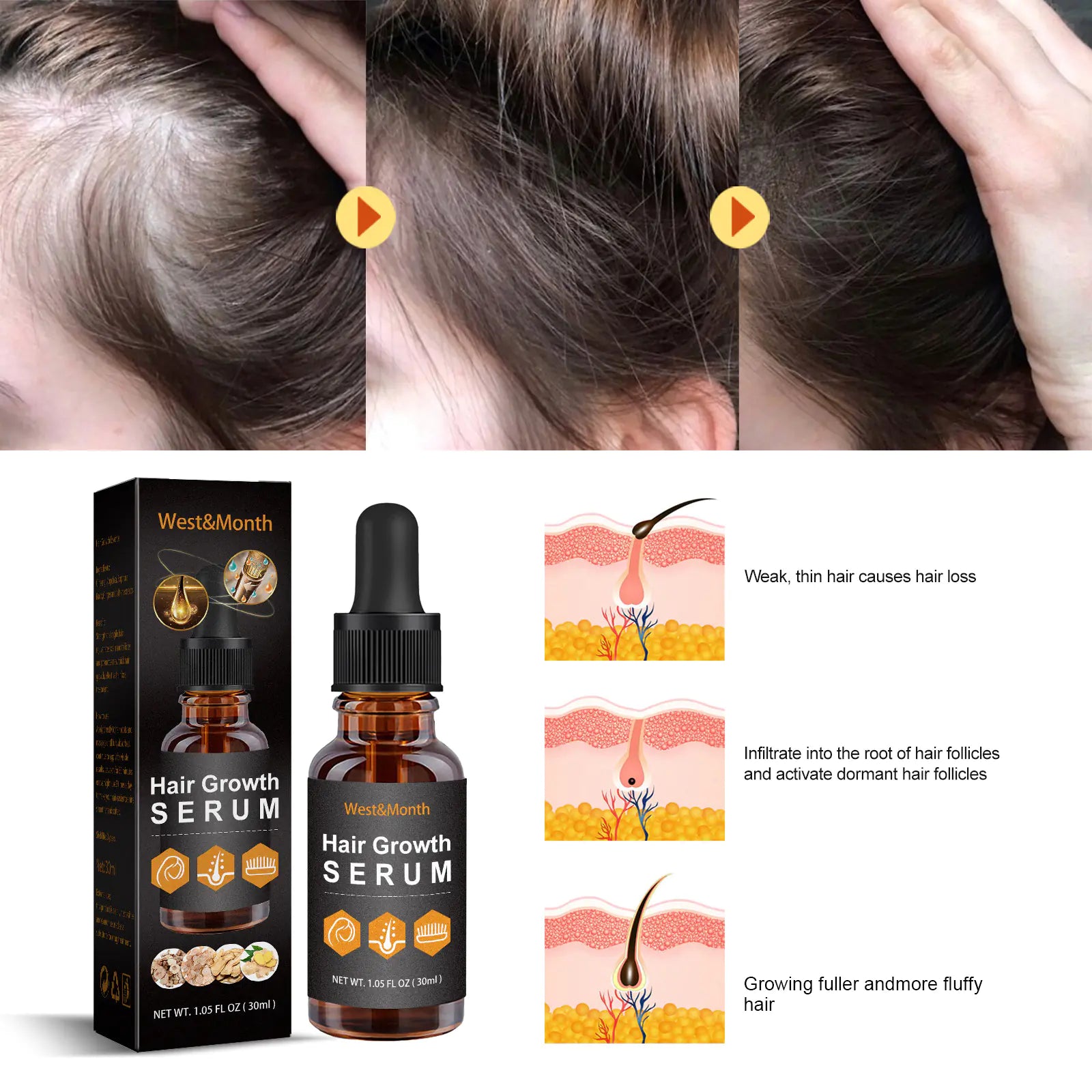 30ml Hair Growth Essence for Strong, Thick Hair Care