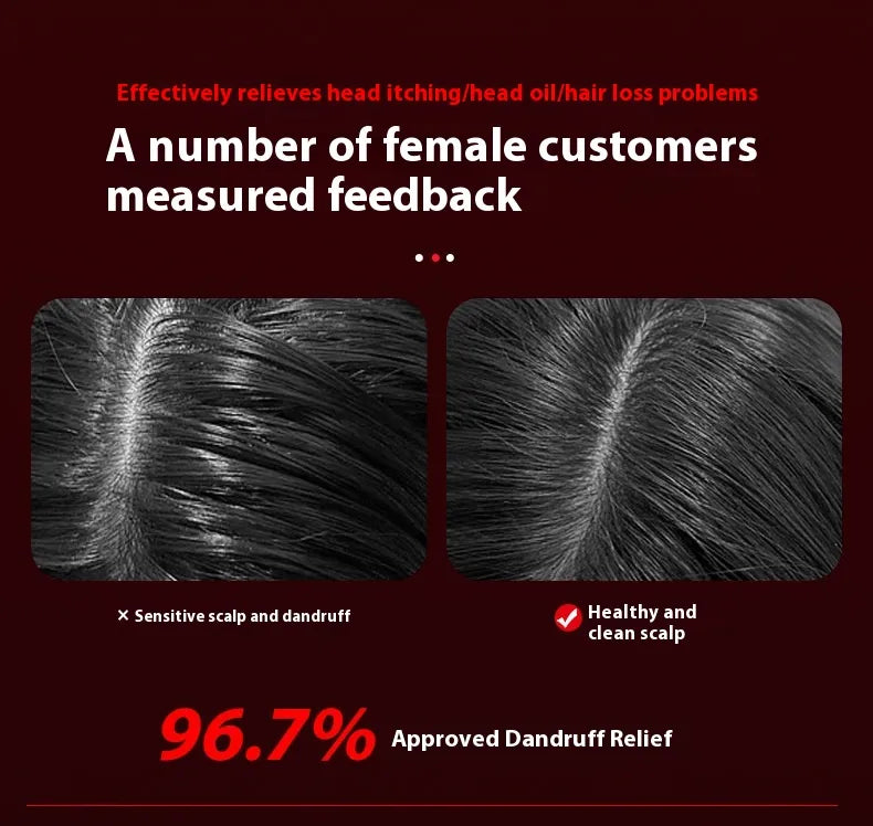 Electric Scalp Massage Comb – Red Light & Hair Care